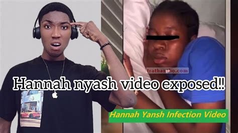 hanna yansh video|Hannah Yansh’s Infection Video Goes Viral on TikTok